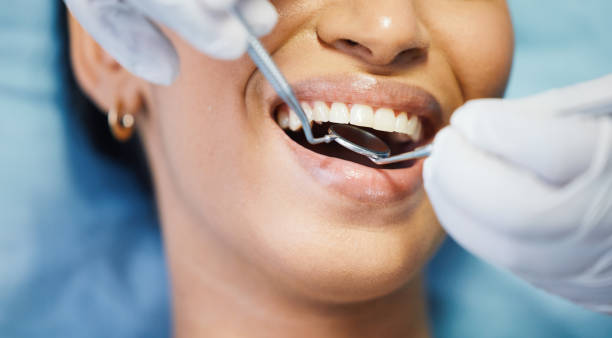 Best Dentist for Tooth Abscess  in Wyanet, IL