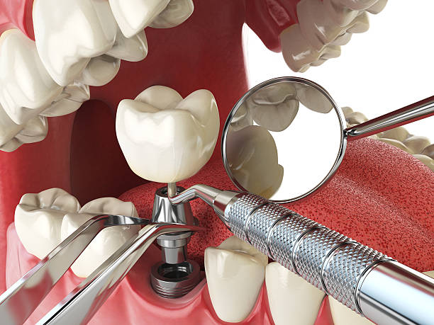 Best Knocked-Out Tooth Emergency  in Wyanet, IL